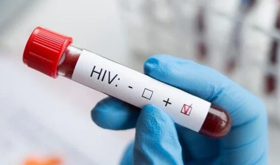 HIV Pozitif Olduğunu Saklayan Kocaya Hapis Cezası