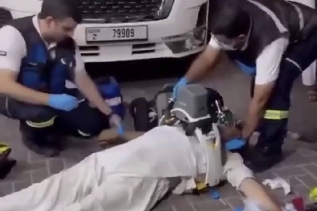 Dubai’de kalp krizi geçiren hasta hayata döndürüldü