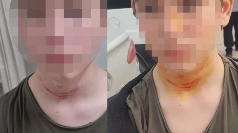 İzmit’te ortaokul öğrencisi okulda darp edildi!